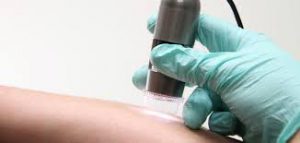 Huidcamera Dermaviduals Haarlem huidonderzoek cosmetica